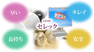 セレック